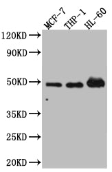 VDR Recombinant Monoclonal Antibody