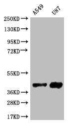 SRR Recombinant Monoclonal Antibody