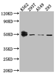WT1 Recombinant Monoclonal Antibody