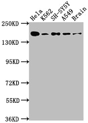 APC Recombinant Monoclonal Antibody