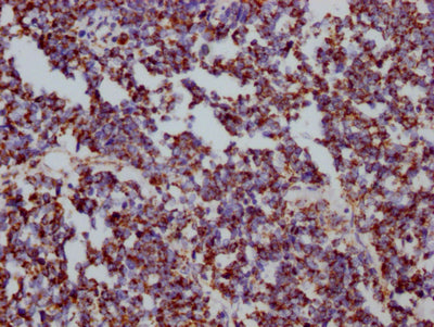 HSPD1 Antibody