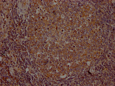 ITK Recombinant Monoclonal Antibody