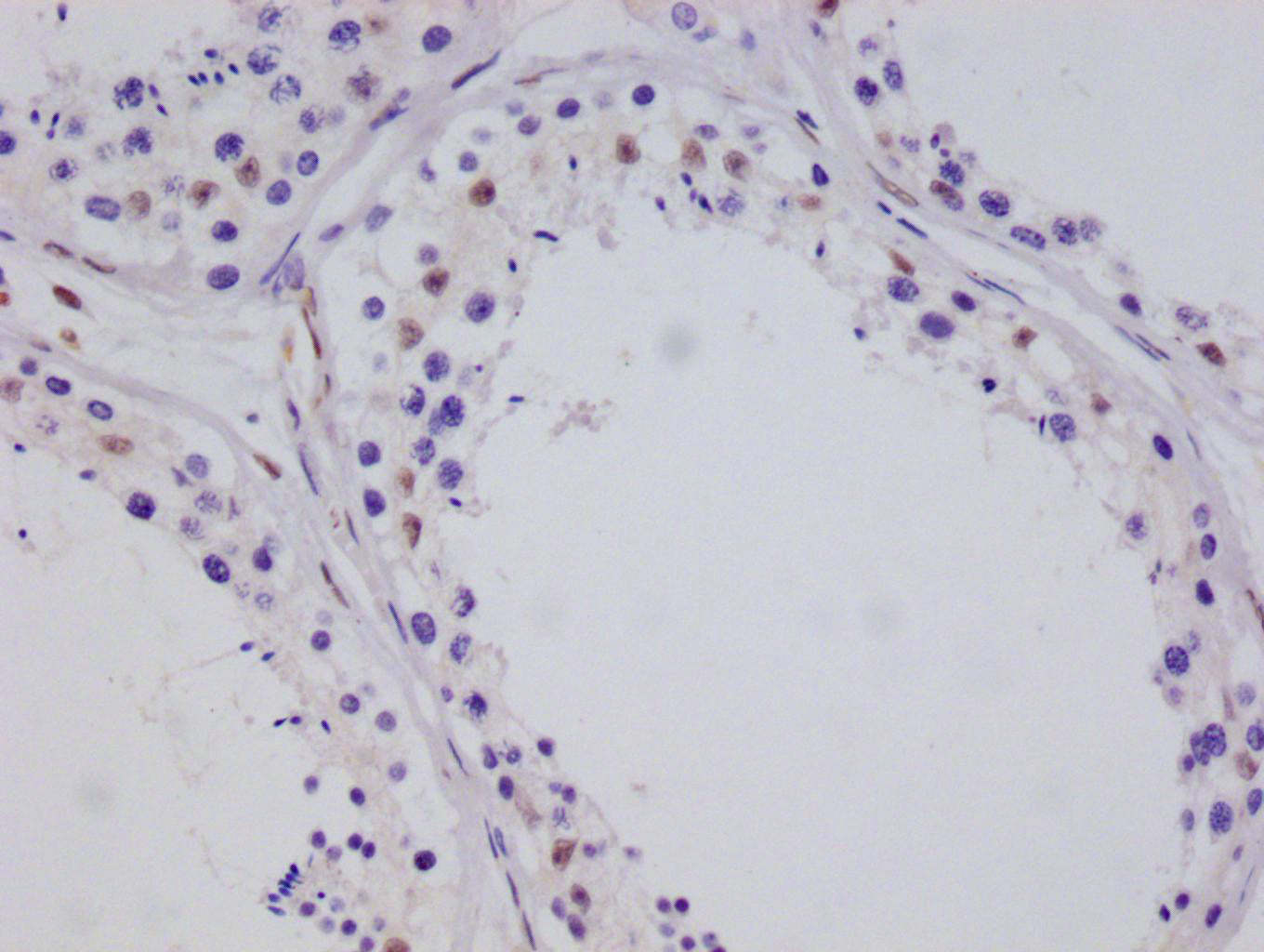 CRTC3 Recombinant Monoclonal Antibody