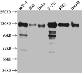 KIF11 Recombinant Monoclonal Antibody