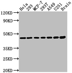 MAP2K1 Recombinant Monoclonal Antibody