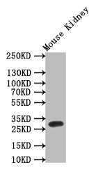 TPSB2 Recombinant Monoclonal Antibody