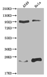 KDM1B Recombinant Monoclonal Antibody