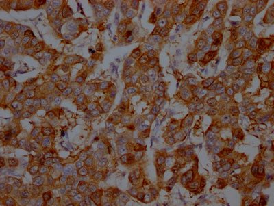 S100A9 Recombinant Monoclonal Antibody