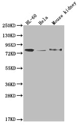 OS9 Recombinant Monoclonal Antibody