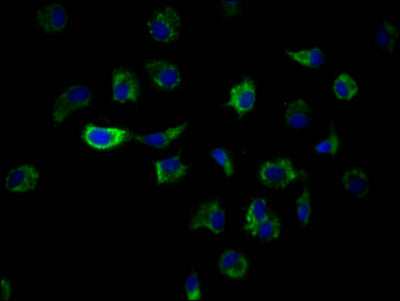 ILK Antibody