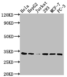 CDK4 Recombinant Monoclonal Antibody