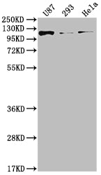 FGFR3 Recombinant Monoclonal Antibody
