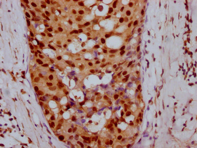 CCNE1 Recombinant Monoclonal Antibody