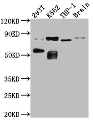 PRKCQ Recombinant Monoclonal Antibody