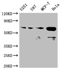 STK3 Recombinant Monoclonal Antibody