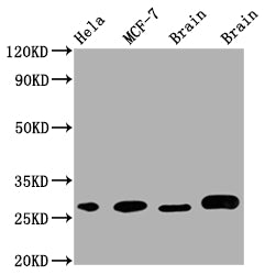 GRB2 Recombinant Monoclonal Antibody
