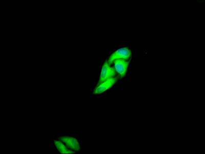 Met Antibody