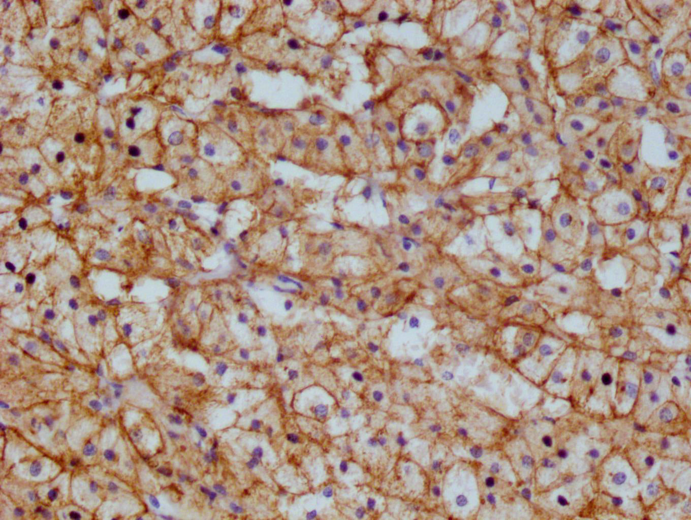 ABCB1 Recombinant Monoclonal Antibody