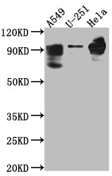 PDE4D Recombinant Monoclonal Antibody
