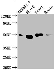 TINF2 Recombinant Monoclonal Antibody