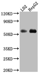 MAOB Recombinant Monoclonal Antibody