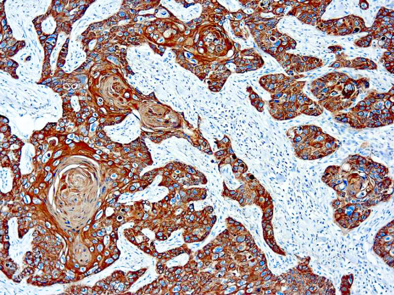 Cytokeratin AE3, Basic