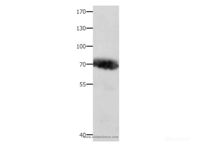 Western Blot analysis of Human liver cancer tissue  using AFP Polyclonal Antibody at dilution of 1:800