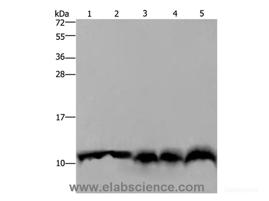 Western Blot analysis of Mouse pancreas tissue, Hela cell and Mouse liver tissue, A549 and 293T cell using UBB Polyclonal Antibody at dilution of 1:500