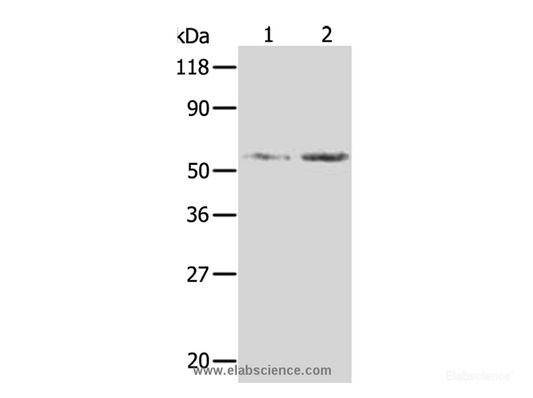 Western Blot analysis of Hela and 293T cell using AKR1B1 Polyclonal Antibody at dilution of 1:350