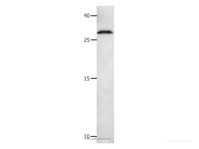 Western Blot analysis of 231 cell  using MMP7 Polyclonal Antibody at dilution of 1:600
