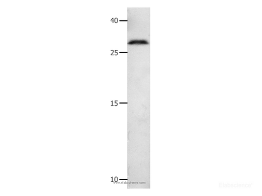 Western Blot analysis of 231 cell  using MMP7 Polyclonal Antibody at dilution of 1:600