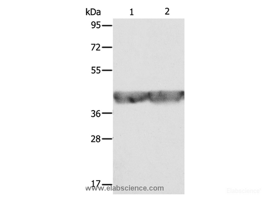 Western Blot analysis of A549 and hela cell using ALDOA Polyclonal Antibody at dilution of 1:500