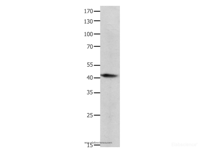 Western Blot analysis of Human lymphoma tissue  using BMP4 Polyclonal Antibody at dilution of 1:350