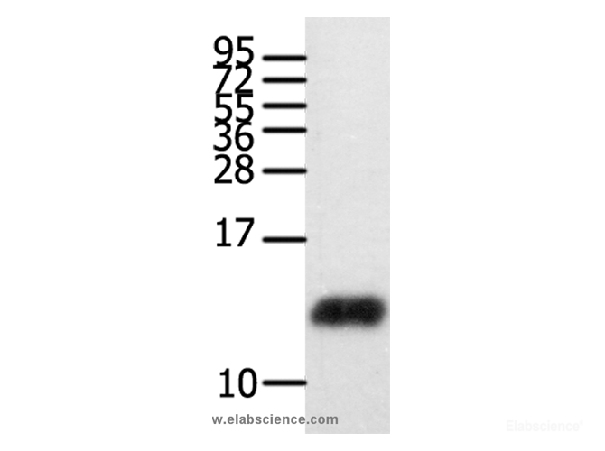 Western Blot analysis of Human brain glioma tissue  using CCL28 Polyclonal Antibody at dilution of 1:450
