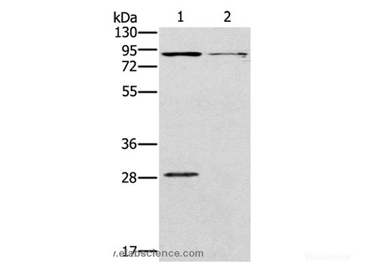 Western Blot analysis of Mouse kidney and brain tissue using CNGA3 Polyclonal Antibody at dilution of 1:500