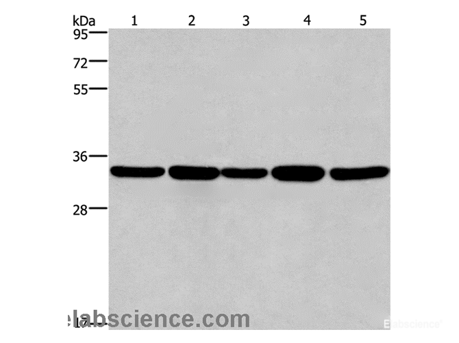 Western Blot analysis of LoVo and A549 cell, Human hepatocellular carcinoma tissue, Jurkat and Hela cell   using E2F6 Polyclonal Antibody at dilution of 1:650