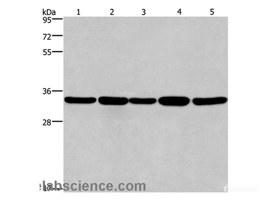 Western Blot analysis of LoVo and A549 cell, Human hepatocellular carcinoma tissue, Jurkat and Hela cell   using E2F6 Polyclonal Antibody at dilution of 1:650