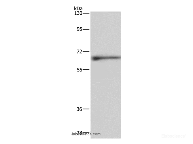 Western Blot analysis of Human hepatocellular carcinoma tissue   using ELN Polyclonal Antibody at dilution of 1:500