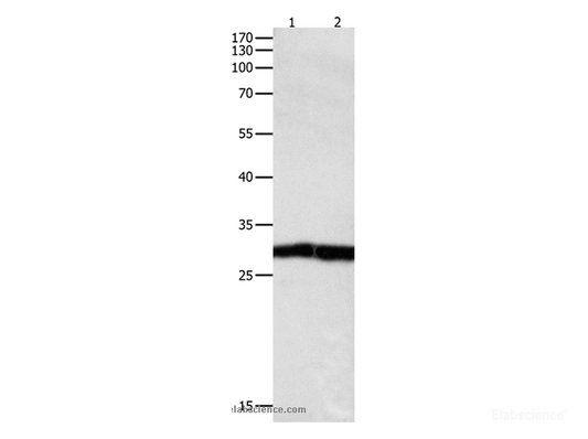 Western Blot analysis of Jurkat cell and Human fetal kidney tissue using MKP-3 Polyclonal Antibody at dilution of 1:450