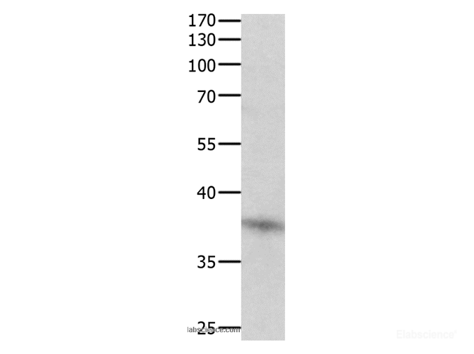 Western Blot analysis of Jurkat cell  using DUSP12 Polyclonal Antibody at dilution of 1:500