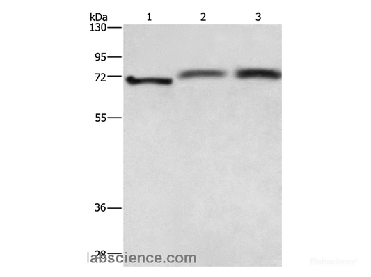 Western Blot analysis of Hela cell, Human fetal brain and hepatocellular carcinoma tissue  using RDX Polyclonal Antibody at dilution of 1:700