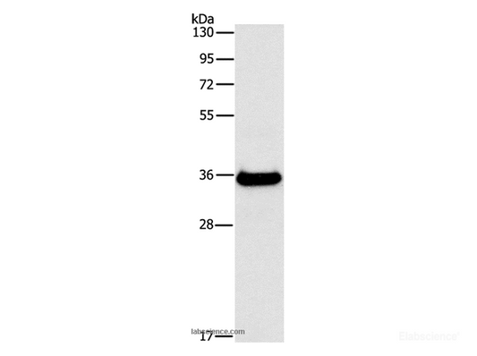 Western Blot analysis of Human fetal liver tissue using FGL1 Polyclonal Antibody at dilution of 1:500