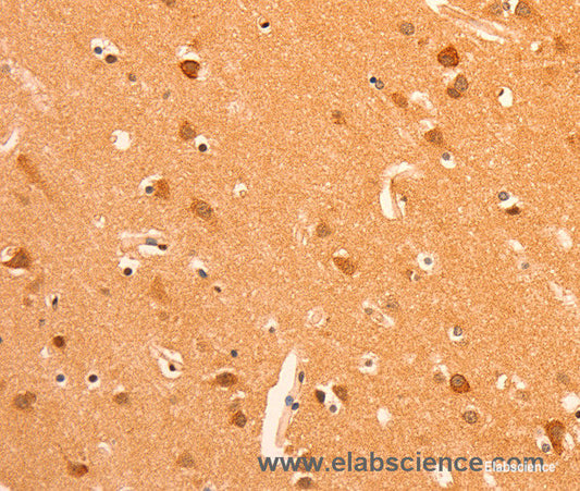 Immunohistochemistry of paraffin-embedded Human brain tissue using GRM3 Polyclonal Antibody at dilution 1:50