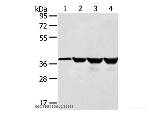 Western Blot analysis of Human normal liver tissue and hepg2 cell, Jurkat and K562 cell using HMOX2 Polyclonal Antibody at dilution of 1:550