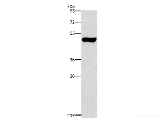 Western Blot analysis of Mouse pancreas tissue using ILK Polyclonal Antibody at dilution of 1:550