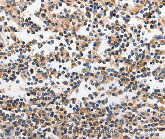 Immunohistochemistry of paraffin-embedded Human tonsil tissue using INHA Polyclonal Antibody at dilution 1:120