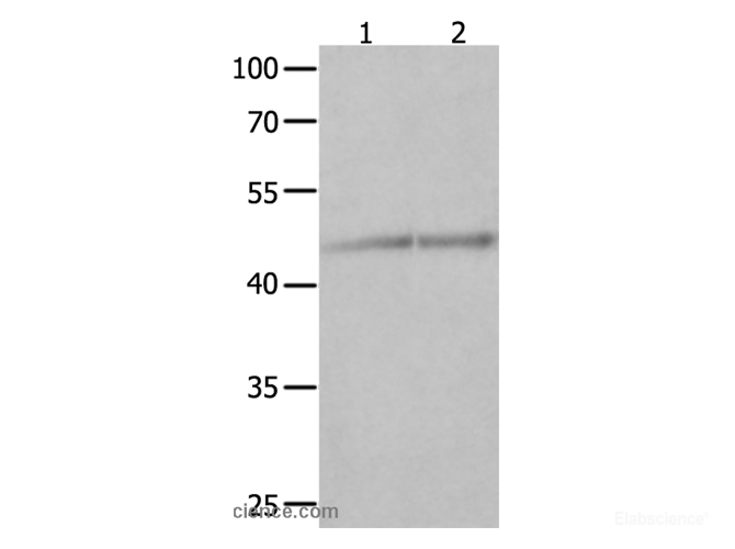 Western Blot analysis of Jurkat and K562 cell  using NCK1 Polyclonal Antibody at dilution of 1:600