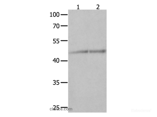 Western Blot analysis of Jurkat and K562 cell  using NCK1 Polyclonal Antibody at dilution of 1:600