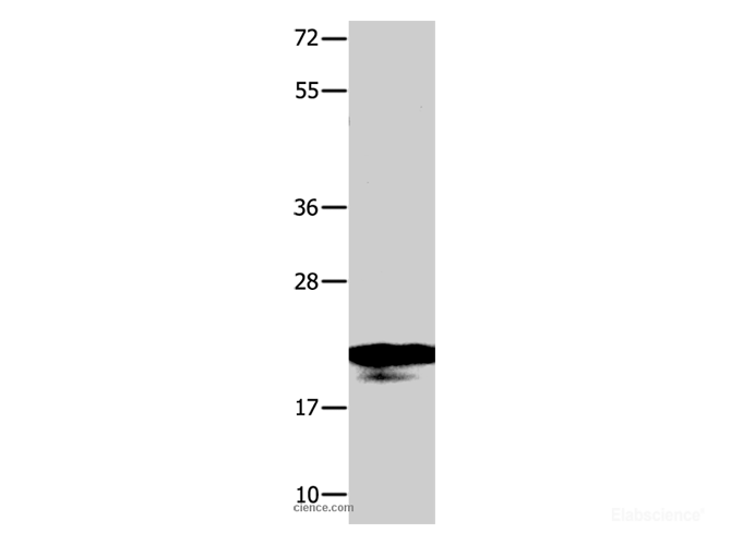 Western Blot analysis of A549 cell  using NME1 Polyclonal Antibody at dilution of 1:950
