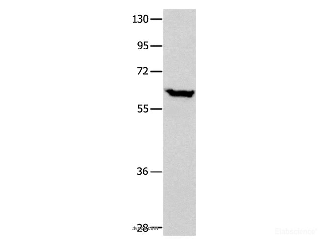 Western Blot analysis of Human seminoma tissue using DNAJC7 Polyclonal Antibody at dilution of 1:400